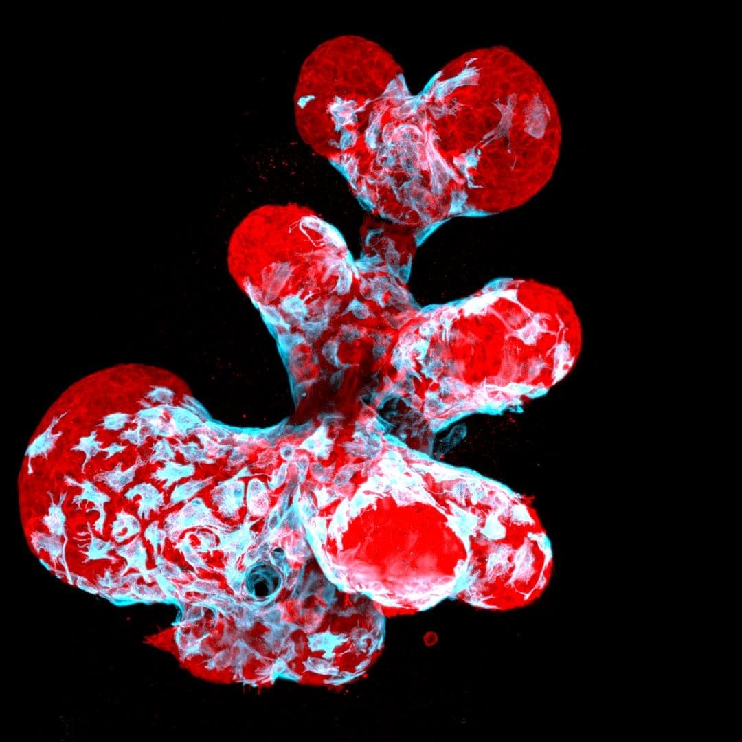 m2-Nikon-Small-World-Photomicrography-Competition-4