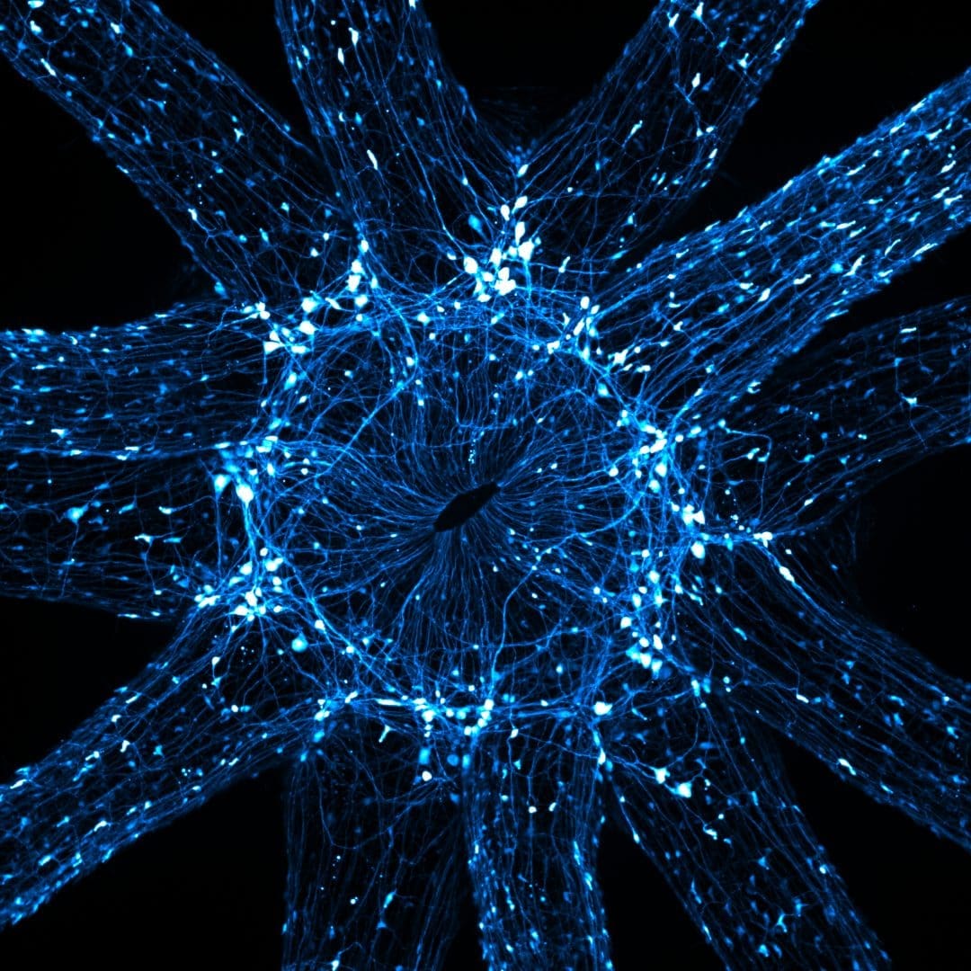 m2-Nikon-Small-World-Photomicrography-Competition-3